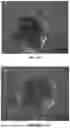 Fig. 09 - METHOD FOR HIGH-EFFICIENCY REGENERATION OF POTATO PROTOPLAST
