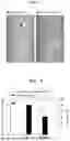 Fig. 07 - ZEBRAFISH ANIMAL MODEL FOR INFLAMMATORY DISEASES AND METHOD FOR SCREEING ANTI-INFLAMMATORY AGENTS USING SAME