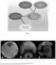 Fig. 02 - BIOCONTROL FORMULATION FOR CONTROLLING PLANT PATHOGENS