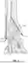 Fig. 02 - THREADED IMPLANT FOR BONE FIXATION AND RELATED METHODS
