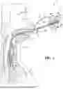 Fig. 02 - BIOPSY DEVICES AND METHODS THEREOF FOR DEPLOYING MARKERS