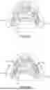 Fig. 24 - SYSTEM AND METHOD FOR IMPROVED INTRA-ORAL SCANNING PROTOCOL AND IMAGE REGISTRATION