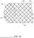 Fig. 08 - BIODEGRADABLE STENTS