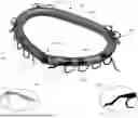 Fig. 01 - TRANSCATHETER ANNULOPLASTY SYSTEM AND METHODS
