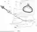 Fig. 02 - TRANSCATHETER ANNULOPLASTY SYSTEM AND METHODS