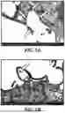 Fig. 02 - MYCOBACTERIOPHAGE COMPOSITIONS AND RELATED METHODS