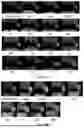 Fig. 09 - PHYTIC ACID-BASED TERNARY COMPLEX BIOMIMETIC NANOMATERIAL, AND PREPARATION METHOD AND USE THEREOF