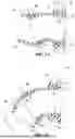 Fig. 09 - SWIVEL ELBOW AND CONNECTOR ASSEMBLY FOR PATIENT INTERFACE SYSTEMS
