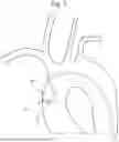 Fig. 08 - STEERABLE CATHETERS