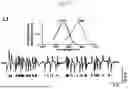 Fig. 29 - KINETIC INTELLIGENT WIRELESS IMPLANT
