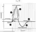 Fig. 97 - KINETIC INTELLIGENT WIRELESS IMPLANT