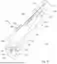Fig. 76 - TRUNK SUPPORTING EXOSKELETON AND METHOD OF USE