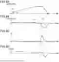 Fig. 07 - CONTROL DEVICE FOR VEHICLE