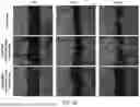 Fig. 45 - Complexes and Compounds of Mercaptophenols and Curcumin for Therapeutic Applications