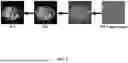 Fig. 02 - DIFFUSION-BASED TUNABLE MEDICAL IMAGING RESTORATION WORKFLOW VIA ITERATIVE REFINEMENTS