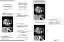 Fig. 06 - DIFFUSION-BASED TUNABLE MEDICAL IMAGING RESTORATION WORKFLOW VIA ITERATIVE REFINEMENTS