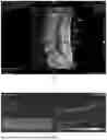 Fig. 02 - SYSTEM AND METHOD OF PREDICTING AND DIAGNOSING OSTEOPOROSIS ON THE BASIS OF MAGNETIC RESONANCE IMAGING TECHNIQUE