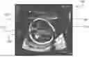 Fig. 01 - METHOD AND SYSTEM FOR IMPROVED ULTRASOUND PLANE ACQUISITION