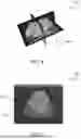 Fig. 05 - METHOD AND SYSTEM FOR IMPROVED ULTRASOUND PLANE ACQUISITION