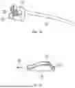 Fig. 28 - SYSTEMS, DEVICES AND METHODS FOR TISSUE FIXATION AND APPROXIMATING TISSUE DEFECTS