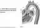 Fig. 02 - FILTER FOR USE WITH A MEDICAL DEVICE