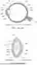 Fig. 02 - Laser Methods and Systems for Addressing Conditions of the Lens
