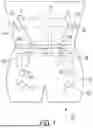 Fig. 02 - PREDICTING ULTRAFILTRATION VOLUME IN PERITONEAL DIALYSIS PATIENTS