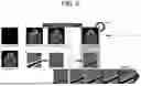 Fig. 06 - APPARATUS AND METHOD FOR NEURAL NETWORK TRAINING OF DENTAL IMAGES THROUGH PATIENT-SPECIFIC DATA AUGMENTATION
