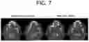 Fig. 08 - APPARATUS AND METHOD FOR NEURAL NETWORK TRAINING OF DENTAL IMAGES THROUGH PATIENT-SPECIFIC DATA AUGMENTATION