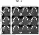 Fig. 09 - APPARATUS AND METHOD FOR NEURAL NETWORK TRAINING OF DENTAL IMAGES THROUGH PATIENT-SPECIFIC DATA AUGMENTATION