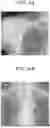 Fig. 05 - MEDICAL IMAGE PROCESSING APPARATUS, MEDICAL IMAGE LEARNING METHOD, AND MEDICAL IMAGE PROCESSING METHOD
