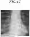 Fig. 06 - MEDICAL IMAGE PROCESSING APPARATUS, MEDICAL IMAGE LEARNING METHOD, AND MEDICAL IMAGE PROCESSING METHOD