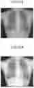 Fig. 07 - MEDICAL IMAGE PROCESSING APPARATUS, MEDICAL IMAGE LEARNING METHOD, AND MEDICAL IMAGE PROCESSING METHOD