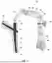 Fig. 02 - INTRAMEDULLARY NAIL AIMING SYSTEMS AND METHODS