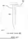 Fig. 136 - TISSUE EXTRACTION DEVICES AND RELATED METHODS