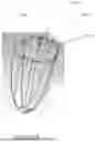 Fig. 255 - TISSUE EXTRACTION DEVICES AND RELATED METHODS