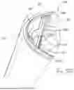 Fig. 33 - TISSUE EXTRACTION DEVICES AND RELATED METHODS