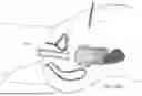 Fig. 79 - TISSUE EXTRACTION DEVICES AND RELATED METHODS