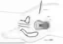 Fig. 82 - TISSUE EXTRACTION DEVICES AND RELATED METHODS