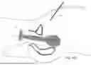 Fig. 84 - TISSUE EXTRACTION DEVICES AND RELATED METHODS