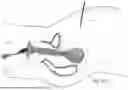 Fig. 87 - TISSUE EXTRACTION DEVICES AND RELATED METHODS