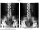 Fig. 04 - SHOCK WAVE LITHOTRIPSY DEVICE HAVING BREATHING TRIGGER FUNCTION