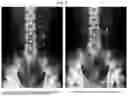 Fig. 05 - SHOCK WAVE LITHOTRIPSY DEVICE HAVING BREATHING TRIGGER FUNCTION