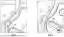 Fig. 06 - ACCESS CATHETER
