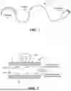 Fig. 02 - CERVICAL SUPPORT SYSTEM AND METHOD OF USE
