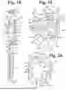 Fig. 09 - MEDICAL IMPLANT THREADED PLUG HAVING A LEADING FACE START STRUCTURE WITH CONCAVE AND CONVEX SURFACES