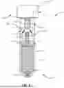 Fig. 07 - ADJUSTABLE TETHER IMPLANT