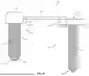 Fig. 08 - ADJUSTABLE TETHER IMPLANT
