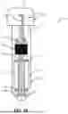Fig. 09 - ADJUSTABLE TETHER IMPLANT