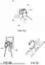 Fig. 06 - DEVICES AND METHODS FOR SPINAL IMPLANT REMOVAL